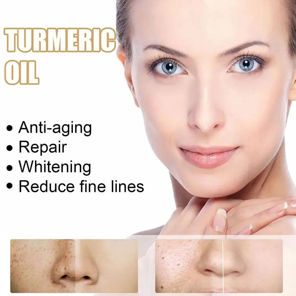 30ml Tumeric Dark Spot & Pigment Correcting Facial Essence Whitening Oil