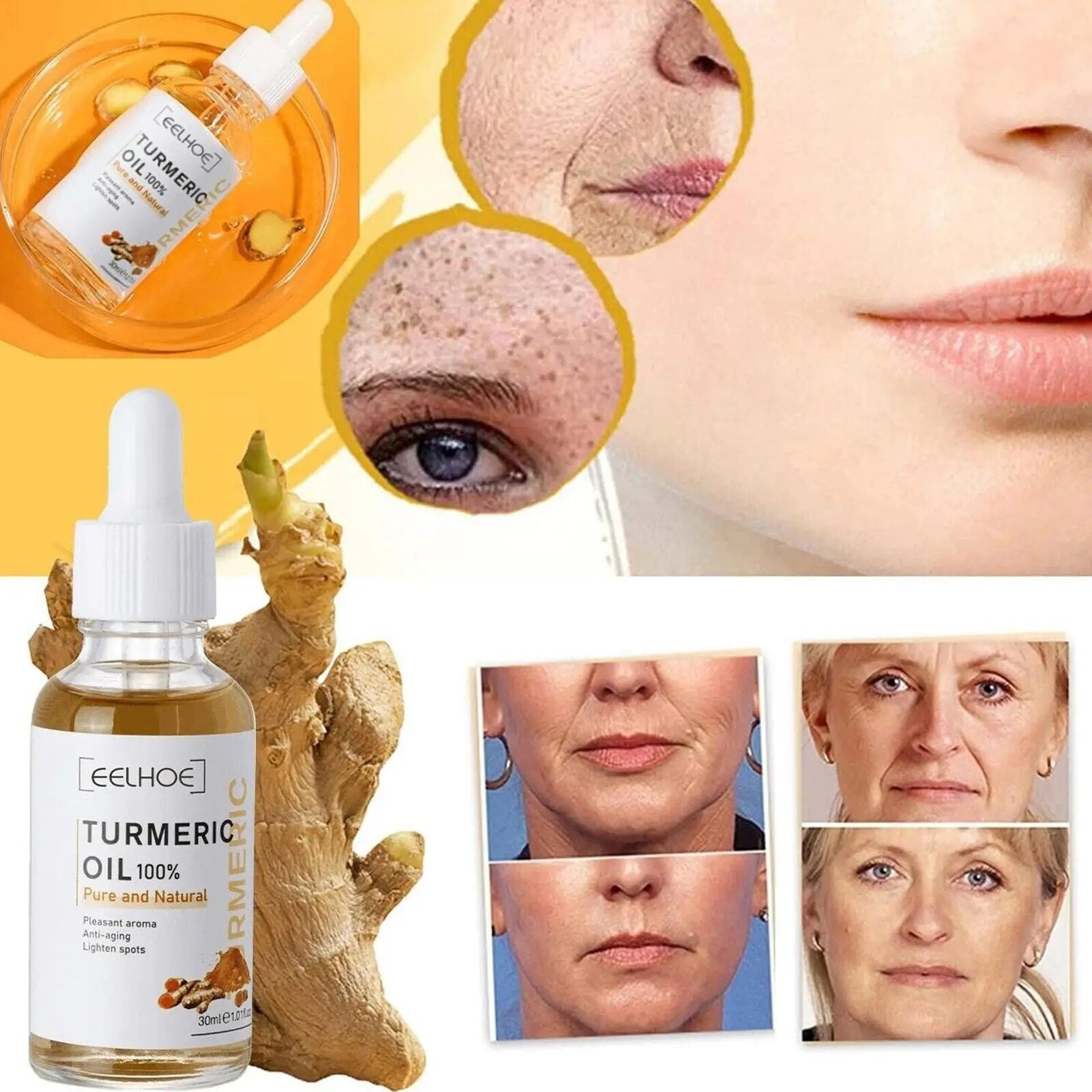 Turmeric Oil Serum Lightening Acne Dark Patches Dark Spot Corrector Anti Aging Face Care 30ml