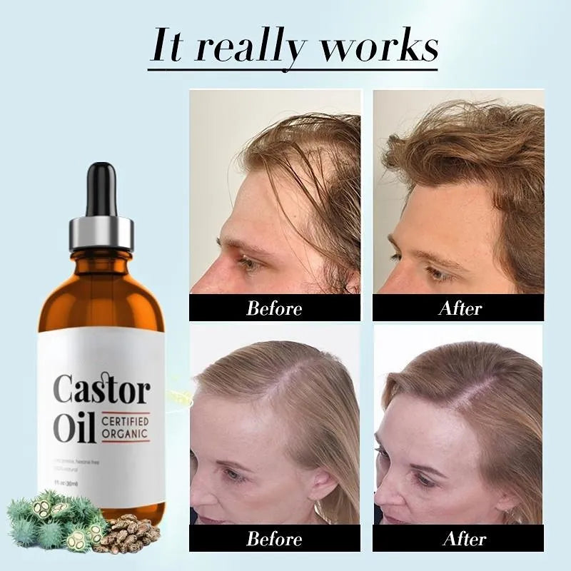 Castor Oil organic Oils - Anti Aging, Hair Growth & Care