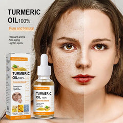 10ml Organic Turmeric Essential Oil for Dark Spots 100 Pure Therapeutic Grade for Moisturizing