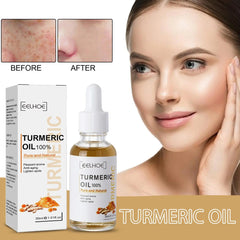 Turmeric Oil Serum Lightening Acne Dark Patches Dark Spot Corrector Anti Aging Face Care 30ml