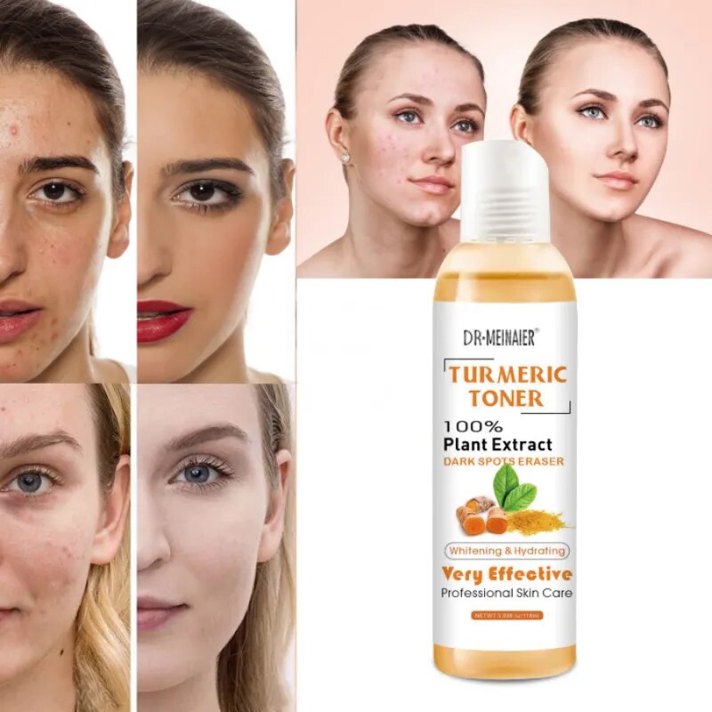 100ml Tumeric Facial Dark Spots Toner, Spots Eraser for Even Flawless Skin Tone