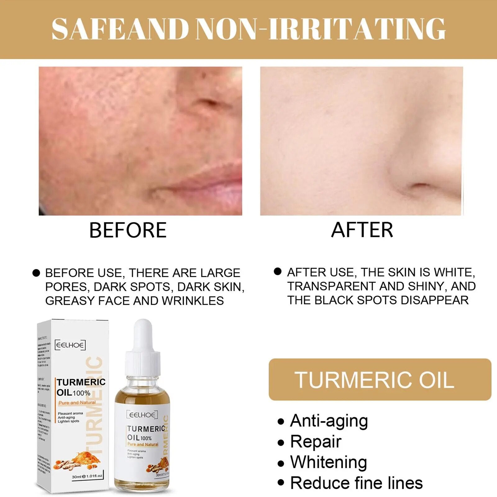 Turmeric Oil Serum Lightening Acne Dark Patches Dark Spot Corrector Anti Aging Face Care 30ml